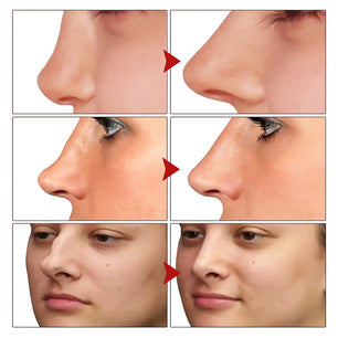 Nose Lifting Oil Nose Up Heighten Rhinoplasty Oil Firming Moisturizing Nasal Bone Remodeling Pure Natural Nose Care Thin Nose